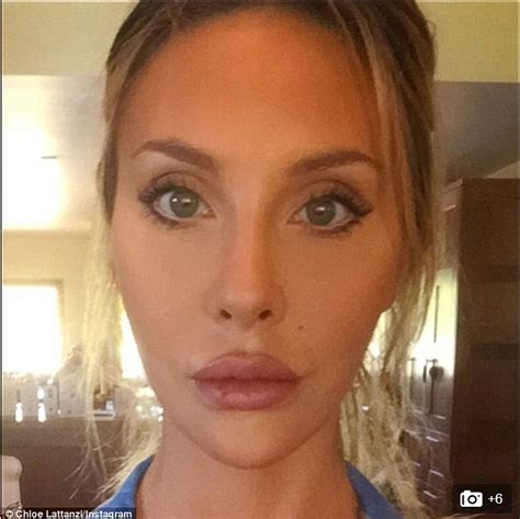 chloe lattanzi surgery|chloe lattanzi instagram.